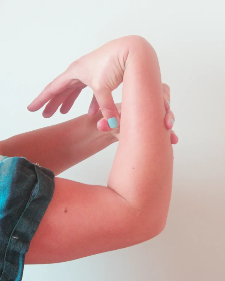 A close‑up of a hypermobile wrist, with the thumb pulled back toward the forearm to demonstrate increased range of movement