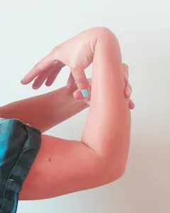 Hypermobile wrist bending backward beyond the typical range of motion.